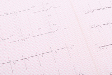 paper with heartbeat readings, close-up background
