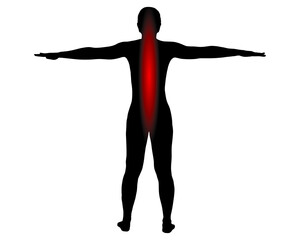 Rückansicht Frau mit Symbol für Schmerzen im Rücken