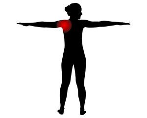 Rückansicht Frau mit Symbol für Schulterschmerzen