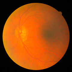 retinal