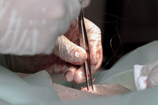 A Veterinary surgeon using surgical instruments during a sterilization surgery on a young female dog 