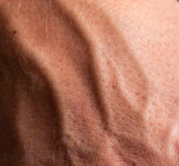 Fototapeta premium veins on a male hand as a background