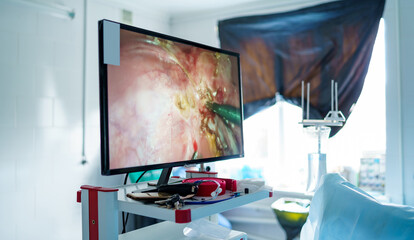 Screen with neurosurgery operation translation. Process of operation on monitor. Modern equipment in hospital.
