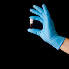 Plastic container for laboratory blood test in the hand of a doctor