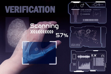 Cyber security network. arm with digital implants and microchips under the skin of the future....