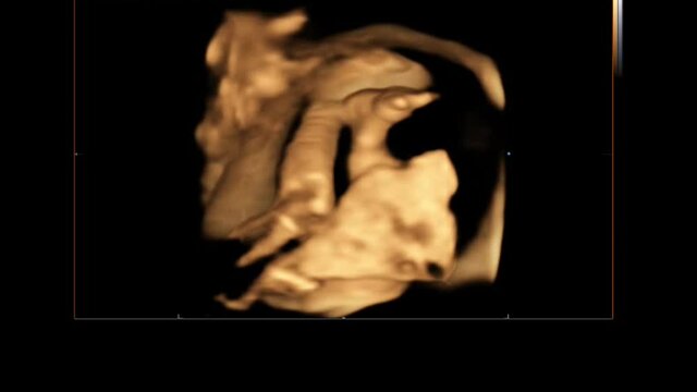 4d Ultrasound echography of fetus in mother's womb