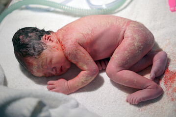 Close-up of newborn asian chinese baby right after delivery