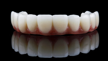 Dental prosthesis of the upper jaw with a pink gum, shot on a black background with reflection