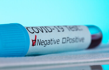 Macro photo of  test tube with a blood sample. Negative test for covid-19, on blue background.