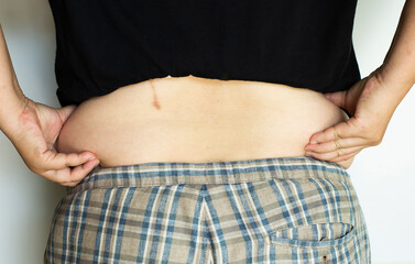 Individual postures show the back muscles that have subcutaneous fat around the waist.