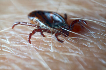 Macro close up of crawling parasitic Dermacentor reticulatus crawling on human skin. Also known as the ornate cow tick, ornate dog tick, meadow tick, and marsh tick. 