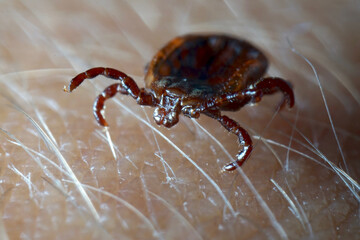 Macro close up of crawling parasitic Dermacentor reticulatus crawling on human skin. Also known as the ornate cow tick, ornate dog tick, meadow tick, and marsh tick. 