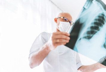 Male doctor examining the patient chest x-ray film lungs scan at radiology department in hospital.Covid-19 scan body xray test detection for covid worldwide virus epidemic spread concept.