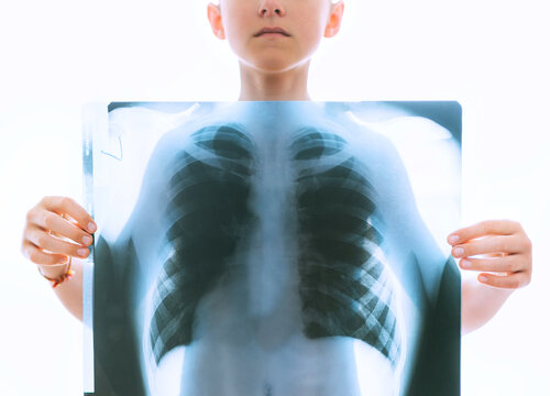 Young teenage boy holding a chest and lungs x-ray film scan in front of the body on the white backlight background. Medical diagnosis and treatment of respiratory diseases concept image.