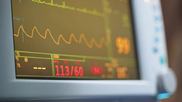 Heart monitor in hospital theatre. Close up of apparatus for measuring heart rate