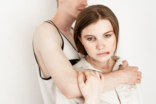 victim of domestic violence, after beating a man hugs a woman, bruises on his face