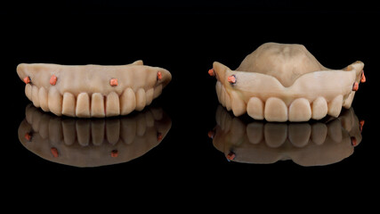 Dental scan dentures with markers for lower and upper jaws on black glass with reflection