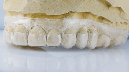 dental cap for plastic surgery to cut the gums of the upper jaw of the patient on a white background, side view