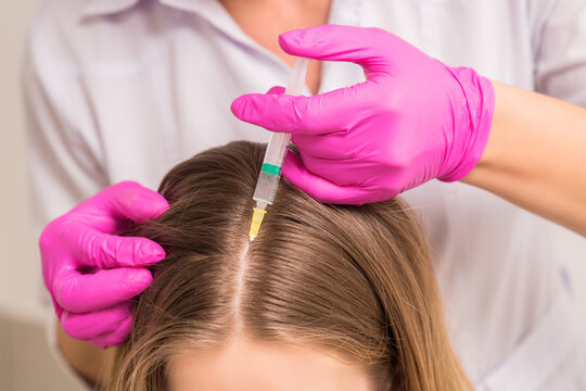 Close up of doctor cosmetologist making mesotherapy injections in head of woman. Concept of mesotherapy.