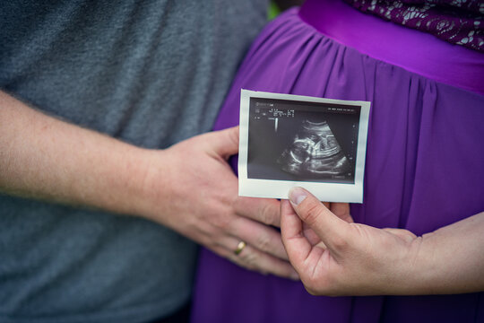 Young couple holds an ultrasound picture of a baby