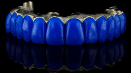 dental wax with teeth from dental wax preparation for the manufacture of dental prosthesis of the upper jaw © Dental Pro Content