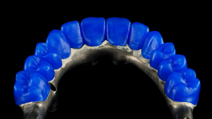 preparation for the manufacture of a dental prosthesis and teeth from blue wax of the upper jaw. view from the inside on a black background