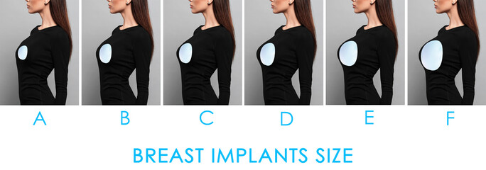 Collage with photos of woman demonstrating different implant sizes for breast on color background,...