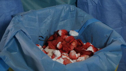 View of bloody tampons and surgical wipes during the surgery operation