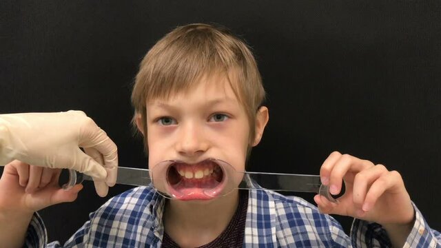 boy at the doctor's appointment with an orthodontist