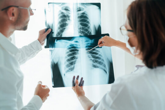 Male doctor and young female colleague examining patient chest x-ray film lungs scan at radiology department in hospital. Covid-19 xray test, covid worldwide virus epidemic spreading concept image.