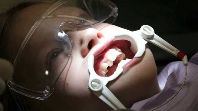 Young girl having brackets put in for braces.