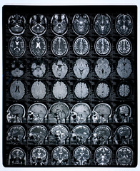Brain MRI of an adult male