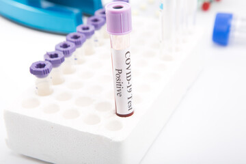 Test tube with a positive COVID-19 test on a white background