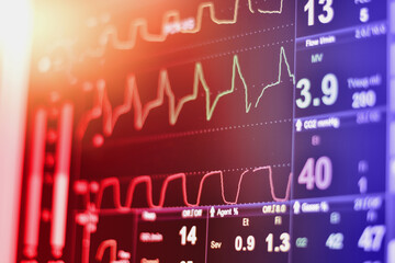 EKG monitor in intra aortic balloon pump machine in icu on blur background, Brain waves in...