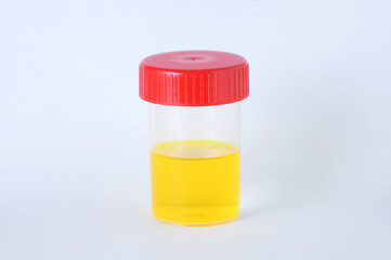 Laboratory can with red cap of urine tests on a white background.