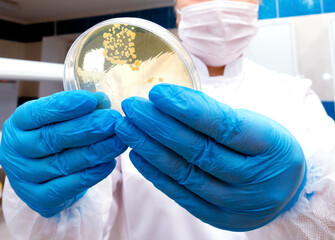 Hand Holds Petri Dish with Bacteria Culture