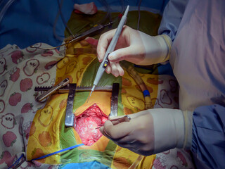 Ross's operation is the surgical treatment of aortic valve defects.