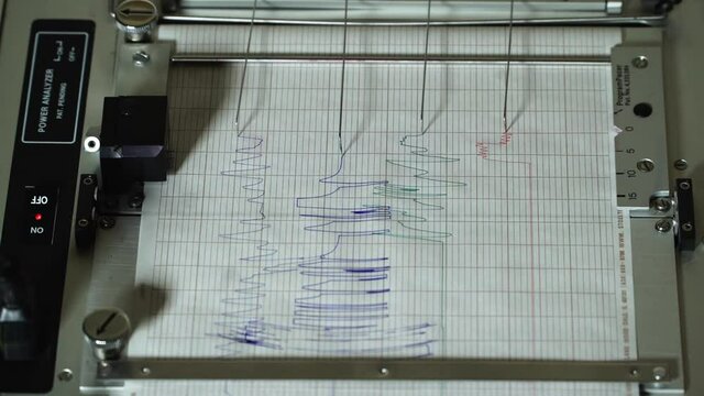 EKG  Machine Readout On Paper Cardiology Close Up