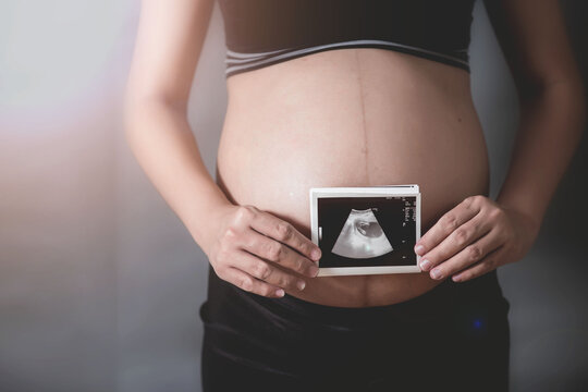  Pregnant women with film pictures,Asian pregnant woman show with ultrasound baby on white background