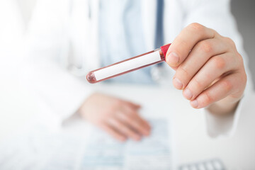 Man doctor with blood test tube in hands