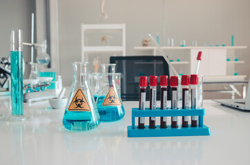 Group of blood or plasma samples that scientists will use in analyzing and researching vaccines to prevent Covid-19 or coronavirus diseases is spreading in the lab. Clean room for medical experiments