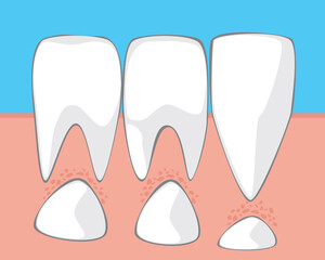 Milk molars in a child’s mouth, flat stock vector illustration with molars and incisors as a concept of changing milk teeth to permanent