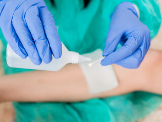 Close-up of a cotton swab and a bottle of antiseptic in the hands of a doctor against the background of a wound on the patient's leg.