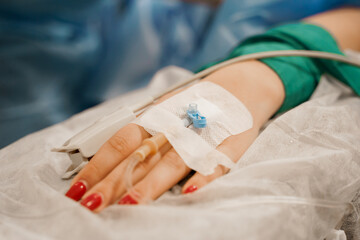 Anesthesia for surgery. Vasofix safely inserted into woman hand on plastic operation.