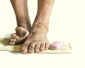 A man's dirty, sore leg on a white background.