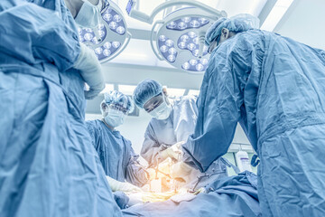 Team of doctor doing surgery inside modern operating room. Asian orthopedic surgeon in blue...