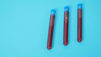 Blood test tubes isolated on blue background.