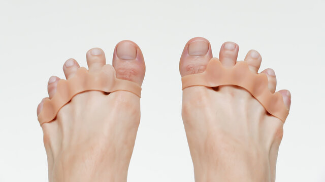 Hallux silicone finger corrector. Repair bent toes.