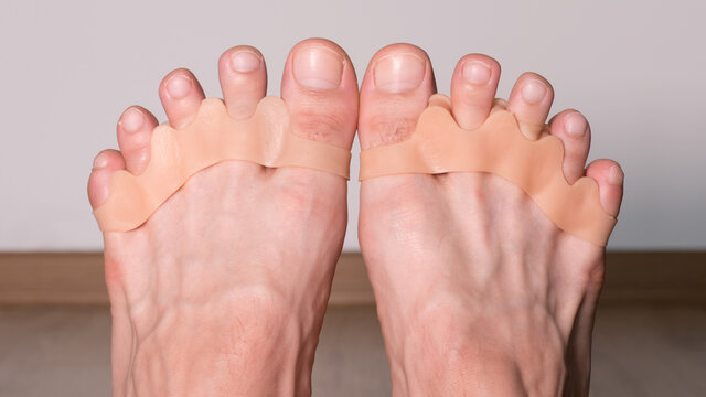 Hallux silicone finger corrector. Repair bent toes and relieves pain in the feet