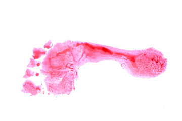 Red footprint isolated on white background. Flat foot test result